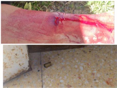 Un hombre fue atacado a  balazos en su propia casa
