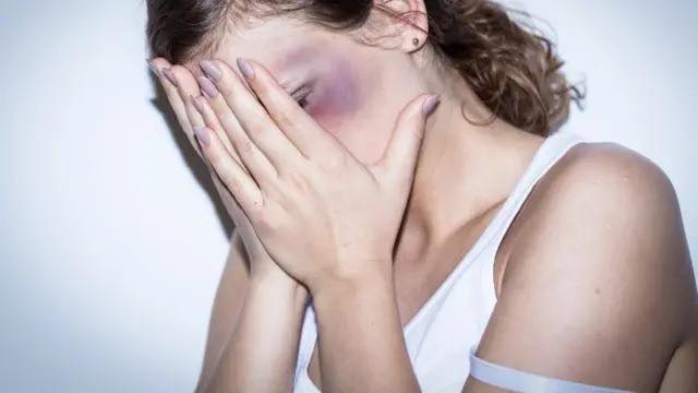 Una jovencita golpeada por su  expareja y luego por su excuñada