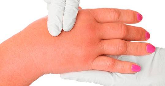 Luego de terminar una  relación golpeó con un  martillo a su ex pareja