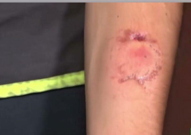 Violencia extrema en pleno centro: mordió a una policía al ser detenida