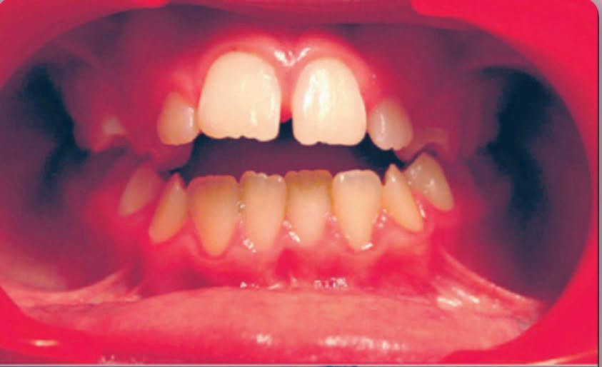 Violenta pelea de pareja: lo mordió en la espalda y lo golpeó en el rostro tras una discusión