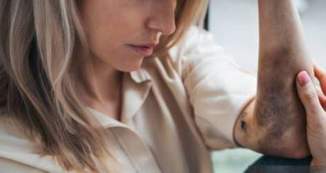 Violenta discusión terminó a golpes: una joven resultó lesionada