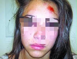 Denunció una violenta agresión por parte  de la novia de su ex